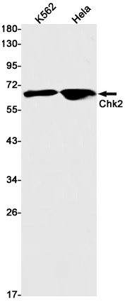 Anti-Chk2 Rabbit mAb [11L38K26]