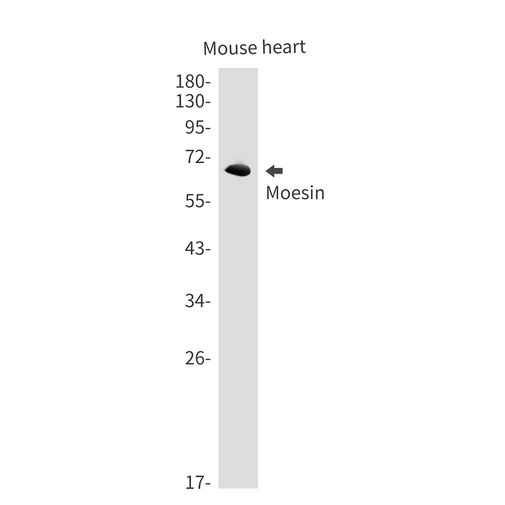 Anti-Moesin Rabbit mAb [82L65L25]