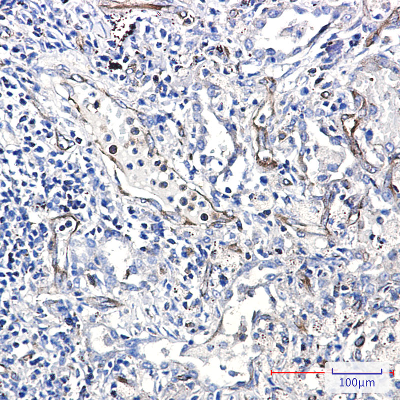 Anti-Moesin Rabbit mAb [82L65L25]