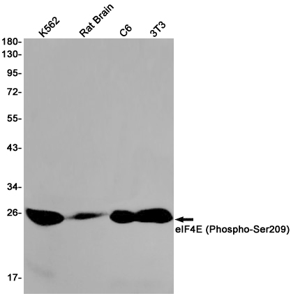 Anti-Phospho-eIF4E (Ser209) Rabbit mAb [79K60M11]