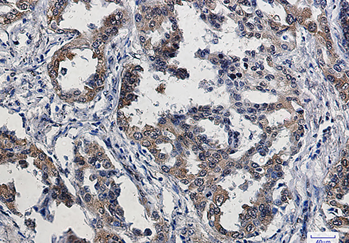 Anti-Phospho-eIF4E (Ser209) Rabbit mAb [79K60M11]