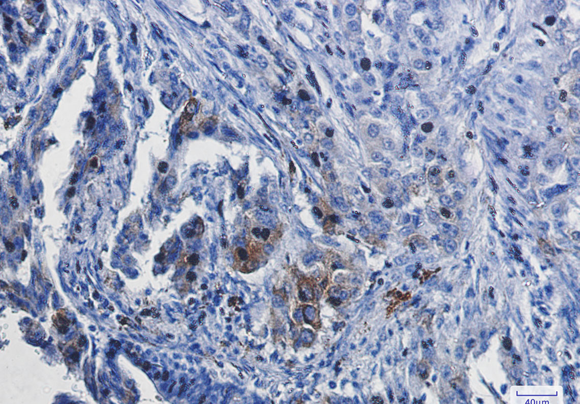 Anti-Heme Oxygenase 1 Rabbit mAb [63L90M37]