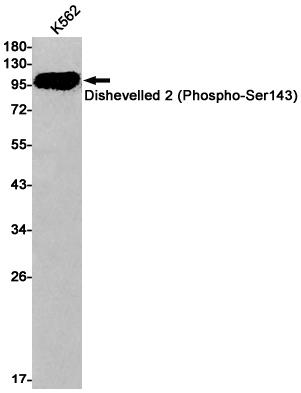 Anti-Phospho-Dishevelled 2 (Ser143) Rabbit mAb [54K04L39]