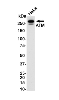 Anti-ATM Rabbit mAb [79L08M54]