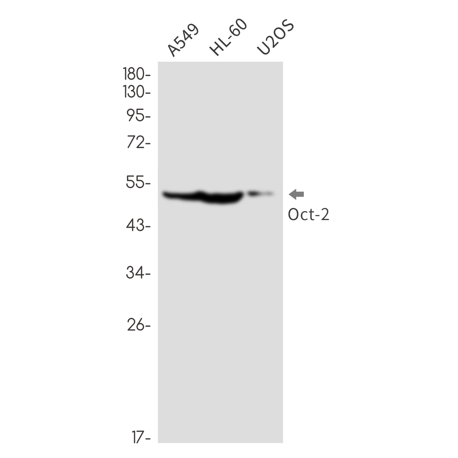 Anti-Oct-2 Rabbit mAb [21L55K12]