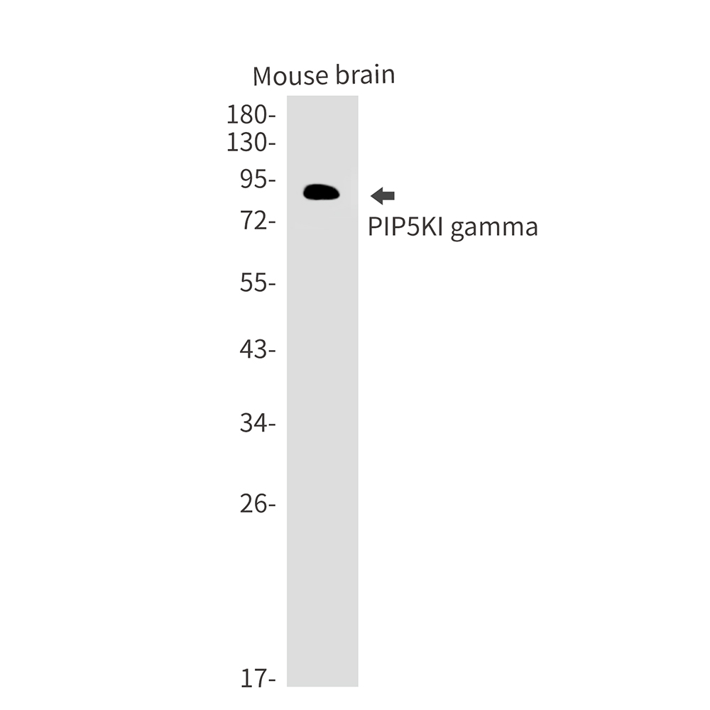Anti-PIP5K1C Rabbit mAb [86M53M77]