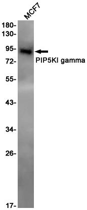 Anti-PIP5K1C Rabbit mAb [86M53M77]