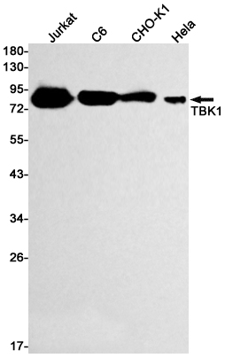 Anti-TBK1 Rabbit mAb [57M95M81]