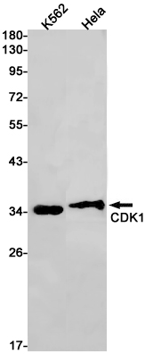 Anti-CDK1 Rabbit mAb [58M66K48]