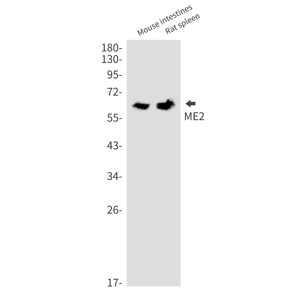 Anti-ME2 Rabbit mAb [23M89K83]