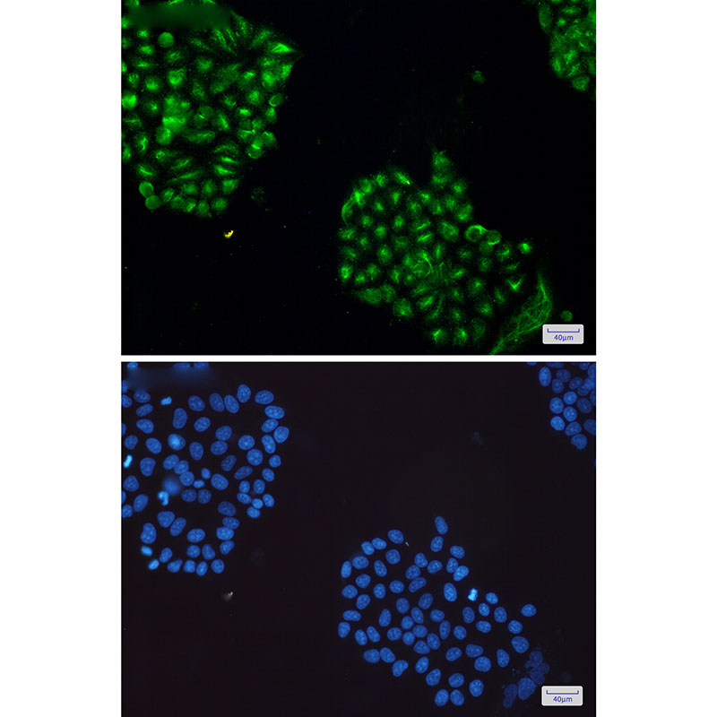 Anti-JNK Rabbit mAb [28K77K23]