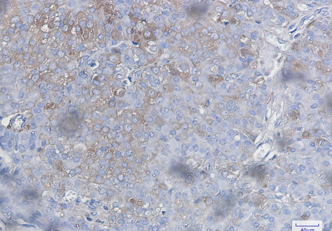 Anti-Bad Rabbit mAb [65M93K19]