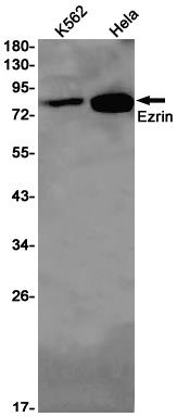 Anti-Ezrin Rabbit mAb [90K67L13]