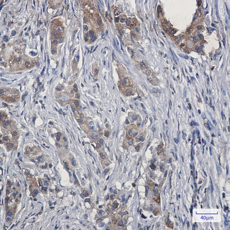 Anti-Ezrin Rabbit mAb [90K67L13]