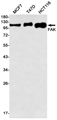 Anti-FAK Rabbit mAb [55L14M74]