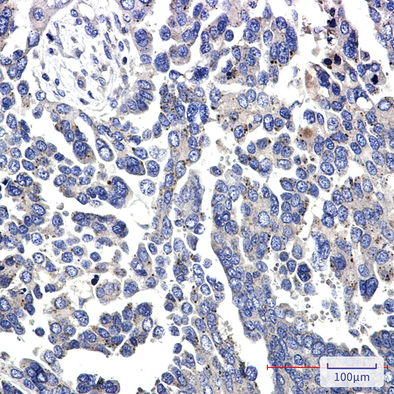 Anti-FAK Rabbit mAb [55L14M74]