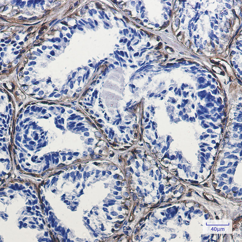 Anti-Caveolin 1 Rabbit mAb [32K49L24]