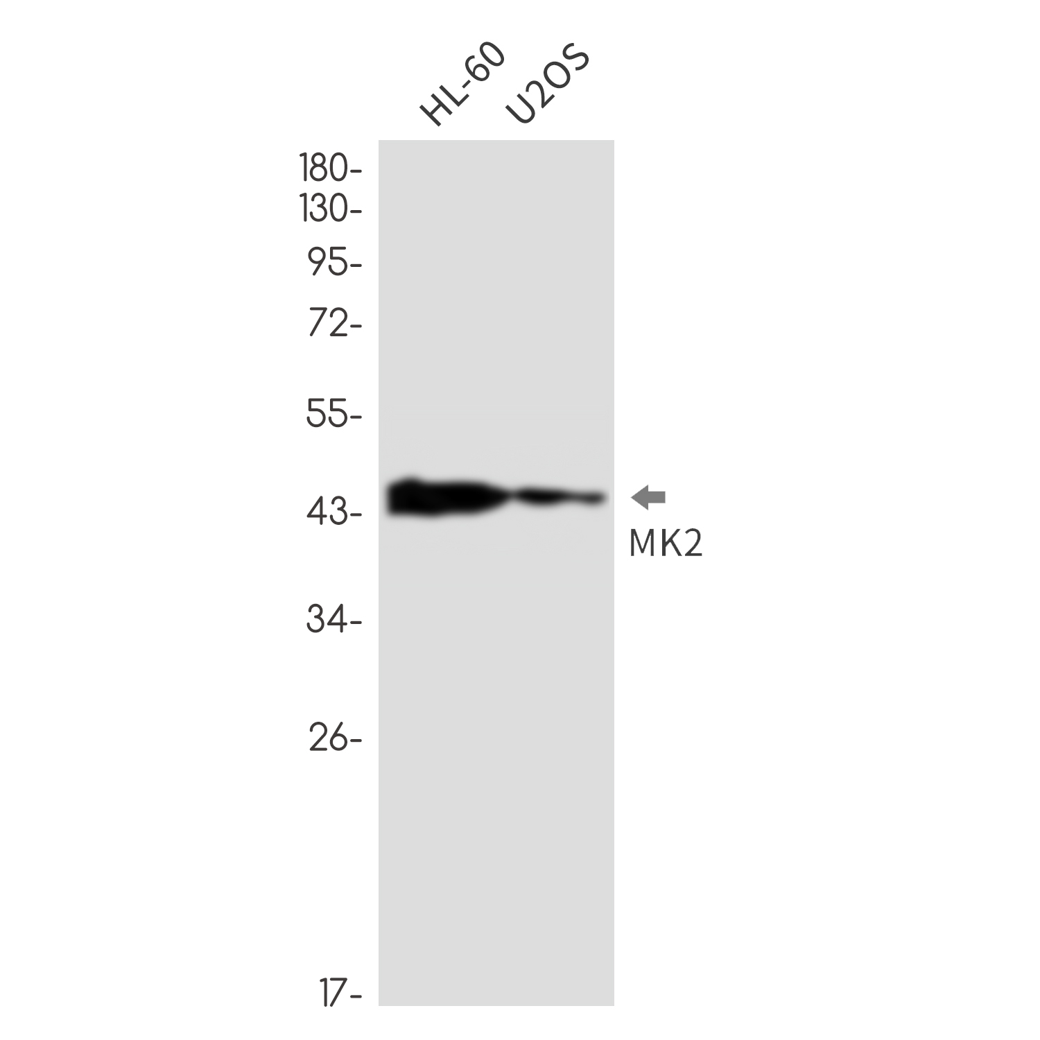 Anti-MAPKAP Kinase 2 Rabbit mAb [22L63K88]