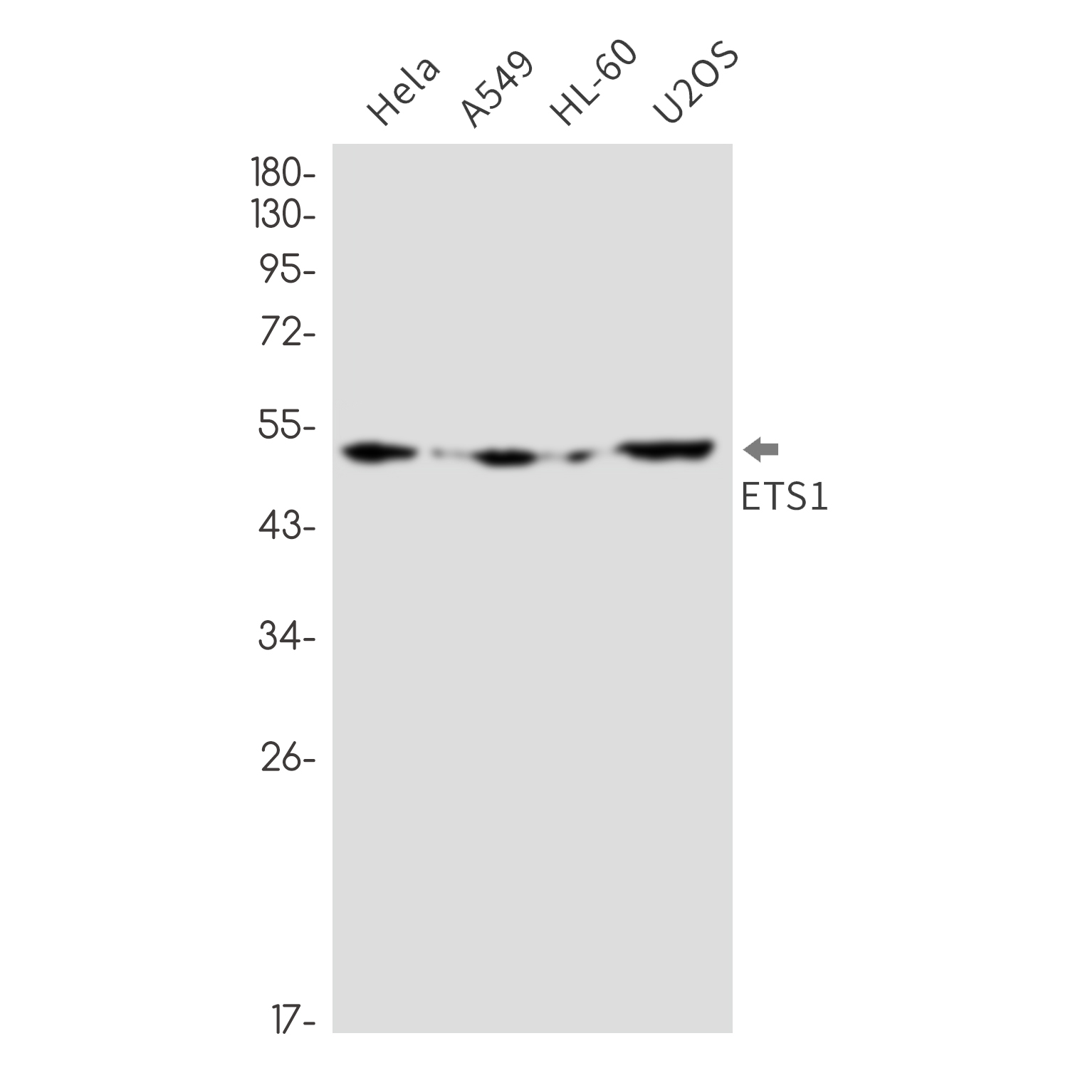 Anti-ETS1 Rabbit mAb [85L02L76]