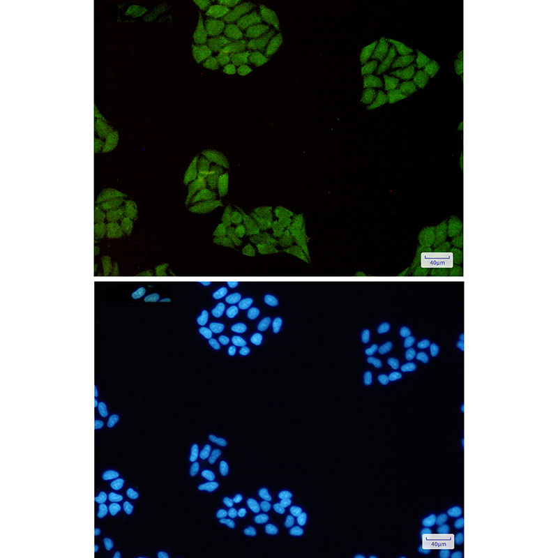 Anti-STAT1 Rabbit mAb [83L56L16]