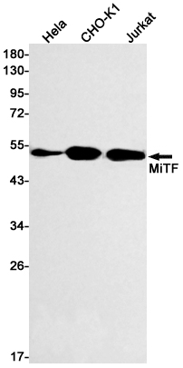 Anti-MiTF Rabbit mAb [53K81L07]