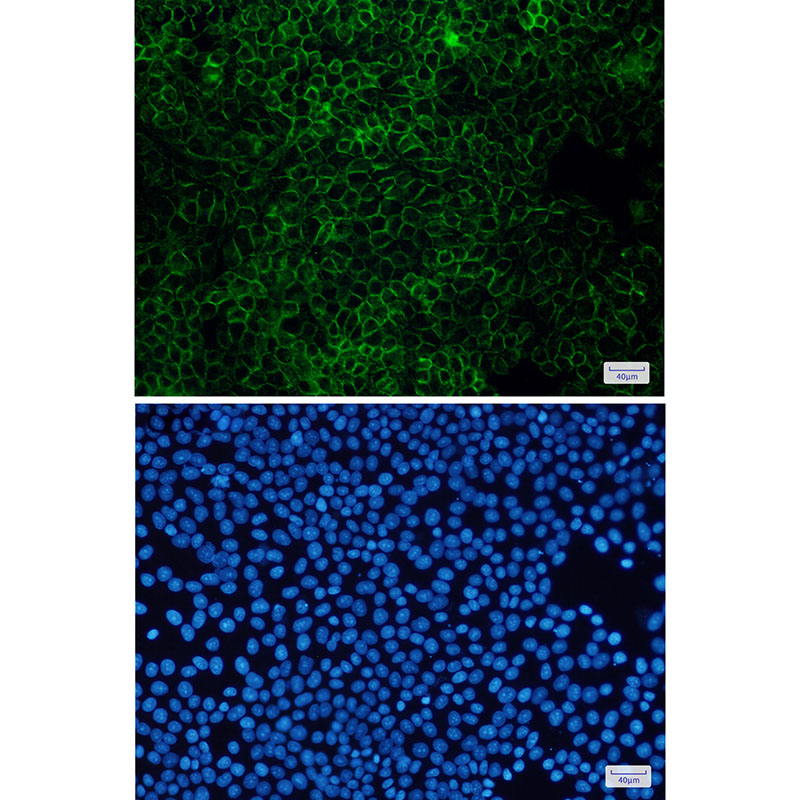 Anti-Flotillin 1 Rabbit mAb [51M47M43]