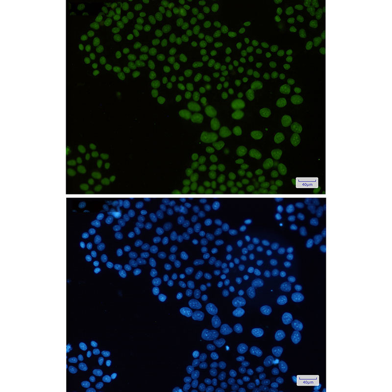 Anti-Macro H2A.1 Rabbit mAb [91M69L34]