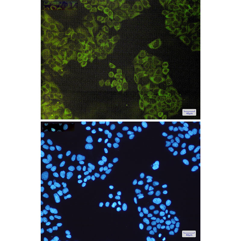 Anti-ATG3 Rabbit mAb [49L18K81]