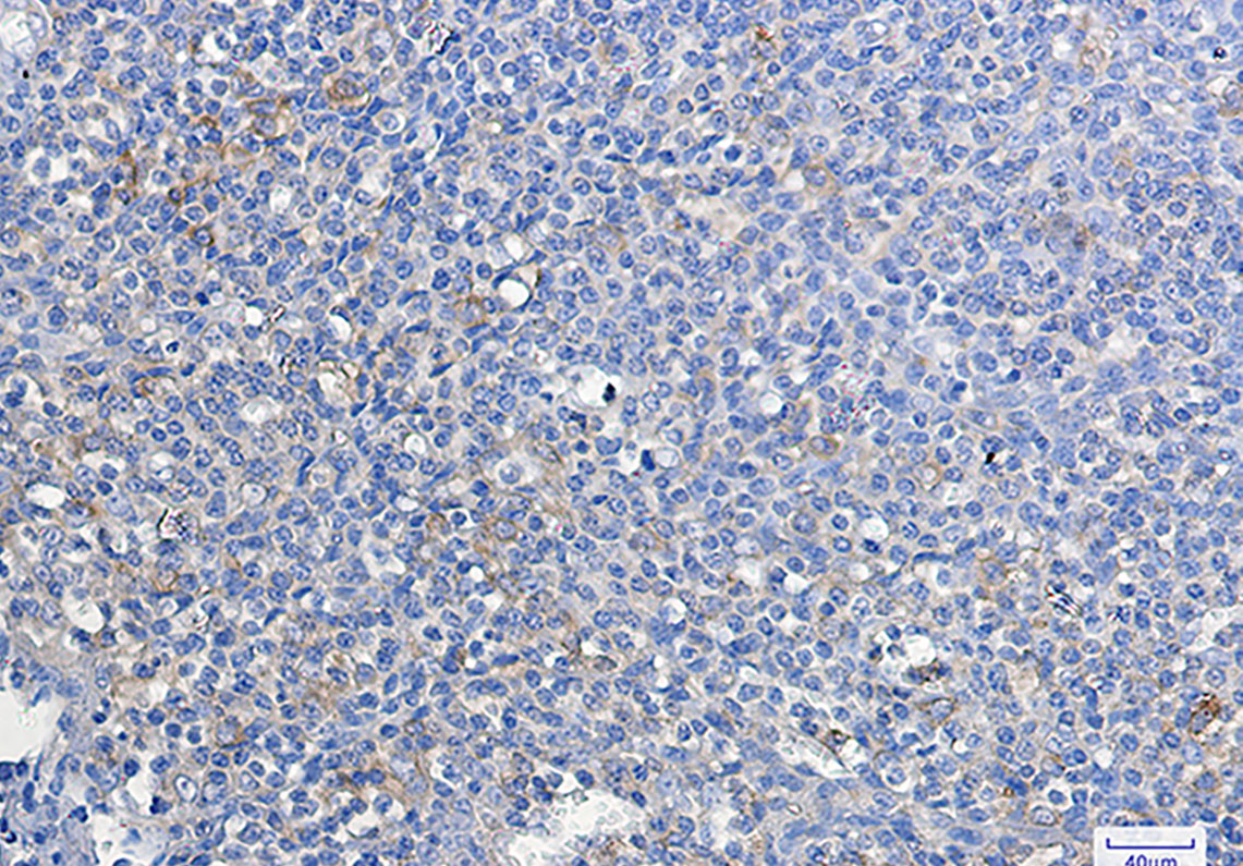 Anti-ATG3 Rabbit mAb [49L18K81]