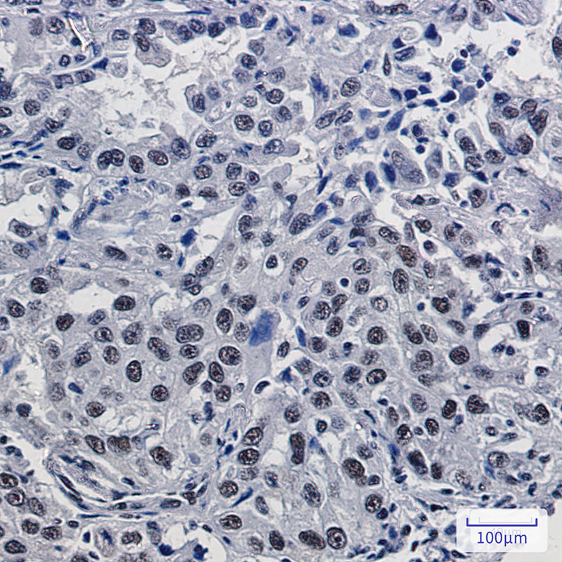 Anti-Mre11 Rabbit mAb [52K93M22]