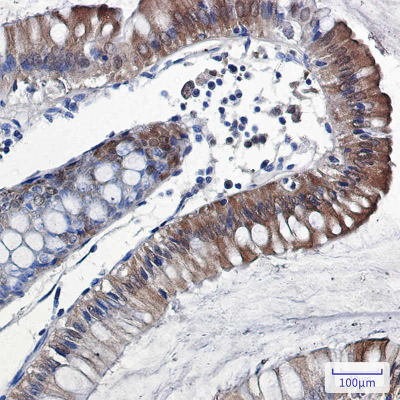 Anti-IL-18 Rabbit mAb [44L89K09]