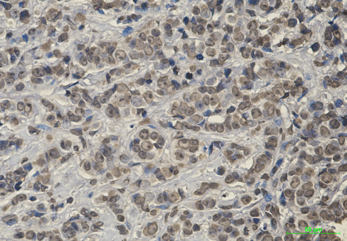 Anti-Keap1 Rabbit mAb [21K02L70]