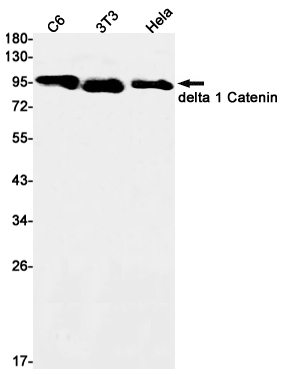 Anti-delta 1 Catenin Rabbit mAb [56L59L40]