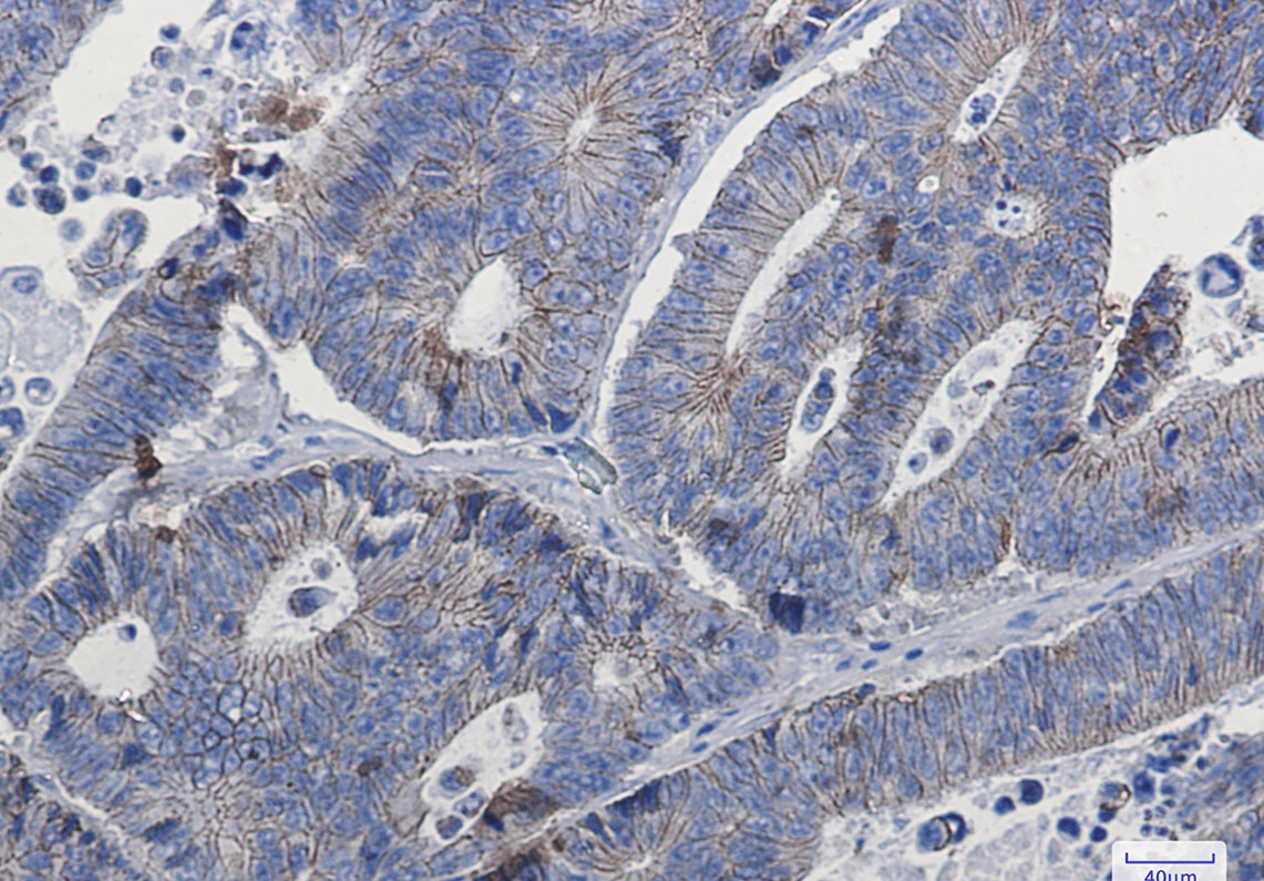 Anti-delta 1 Catenin Rabbit mAb [56L59L40]