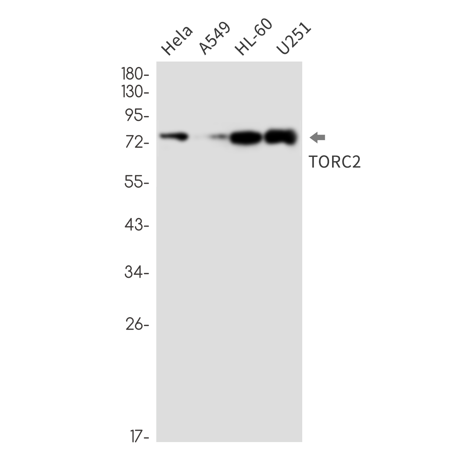 Anti-TORC2 Rabbit mAb [78K86K19]