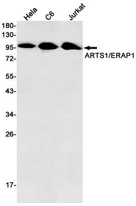 Anti-ERAP1 Rabbit mAb [28L04L76]