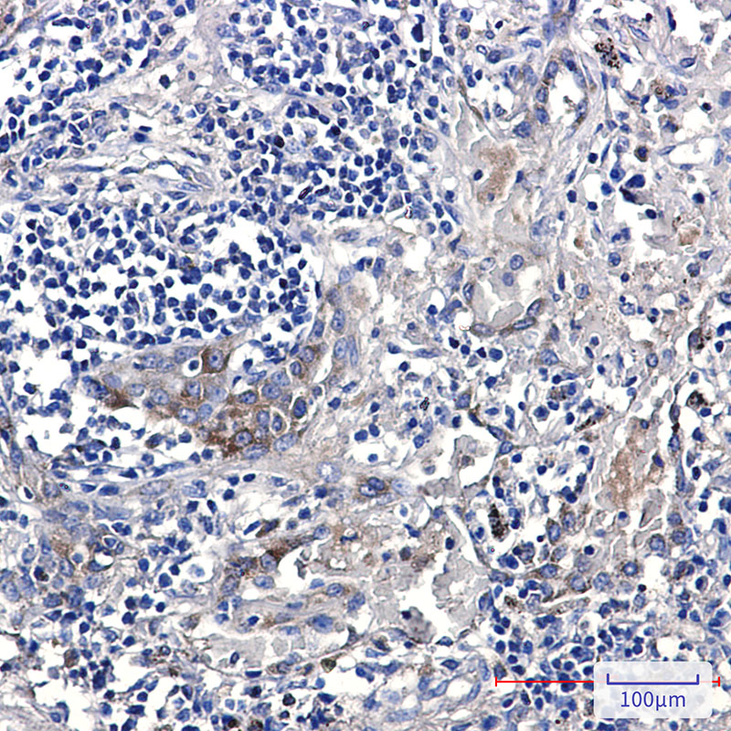 Anti-ERAP1 Rabbit mAb [28L04L76]