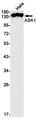 Anti-ASK1 Rabbit mAb [42L29K26]