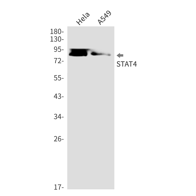 Anti-STAT4 Rabbit mAb [43M02L84]