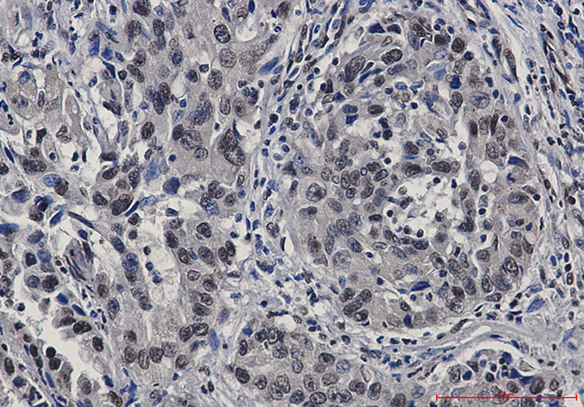 Anti-STAT4 Rabbit mAb [43M02L84]