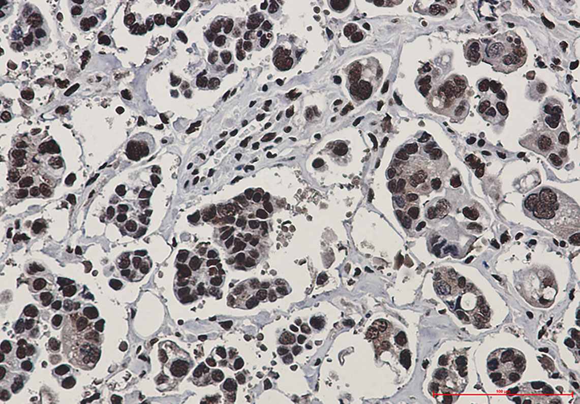 Anti-Rad50 Rabbit mAb [55K05L10]
