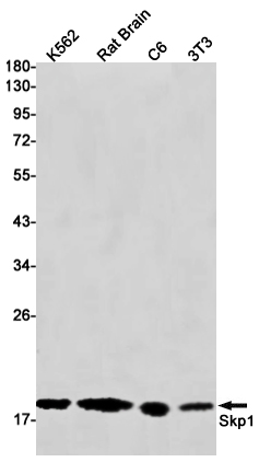 Anti-SKP1 Rabbit mAb [75K01L93]
