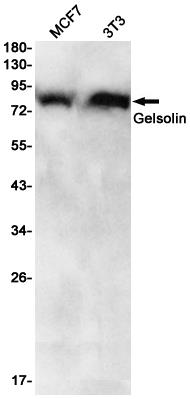 Anti-Gelsolin Rabbit mAb [18M94M98]