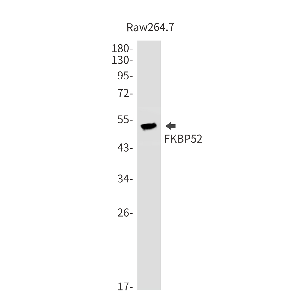 Anti-FKBP52 Rabbit mAb [21M93K86]