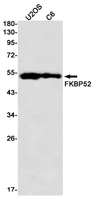 Anti-FKBP52 Rabbit mAb [21M93K86]
