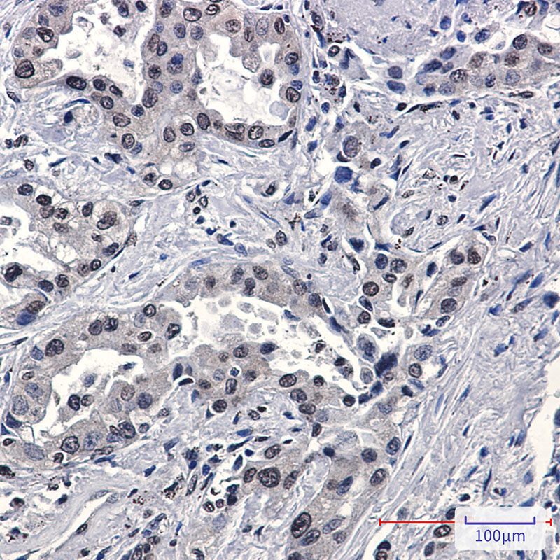 Anti-FKBP52 Rabbit mAb [21M93K86]