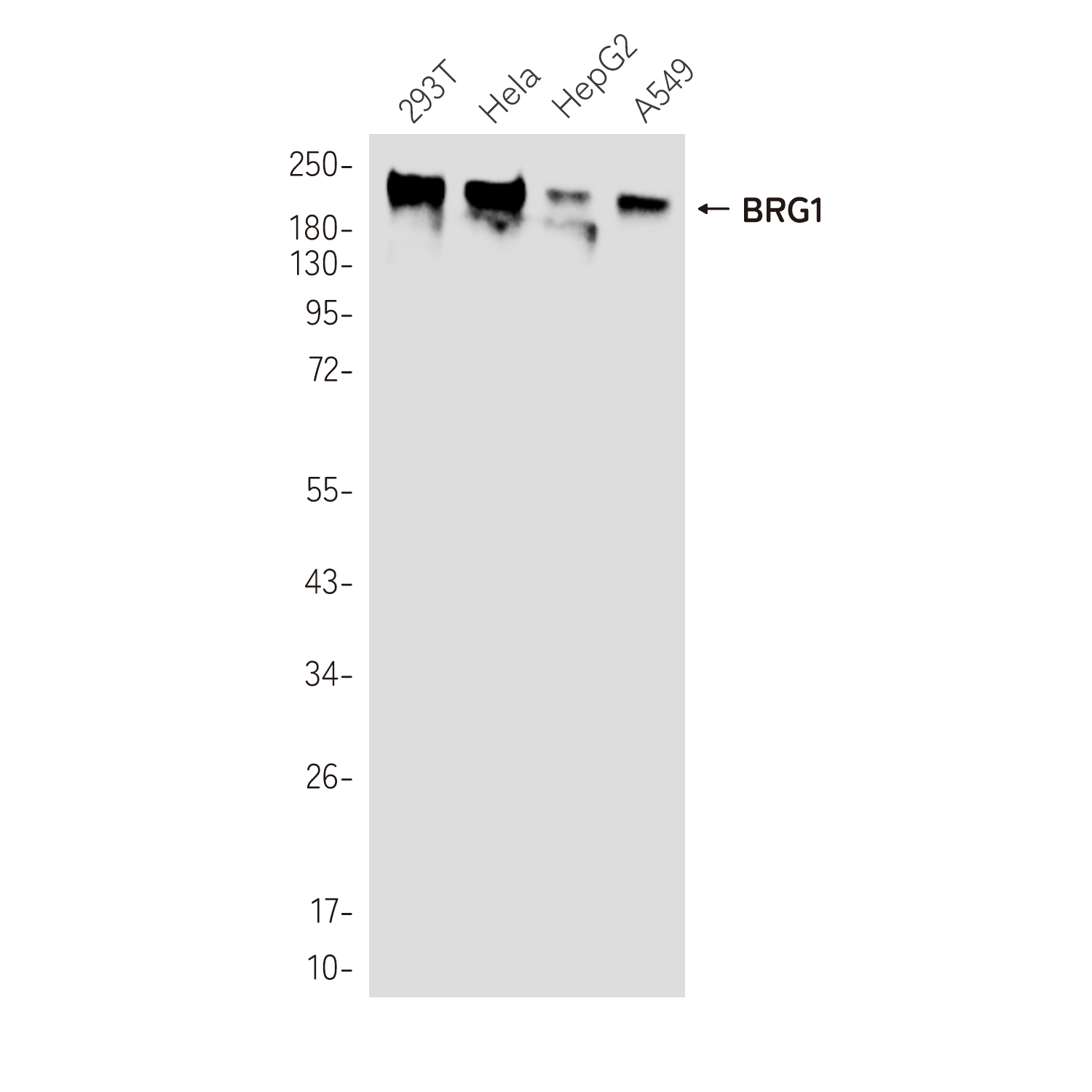 Anti-BRG1 Rabbit mAb [18L06L09]