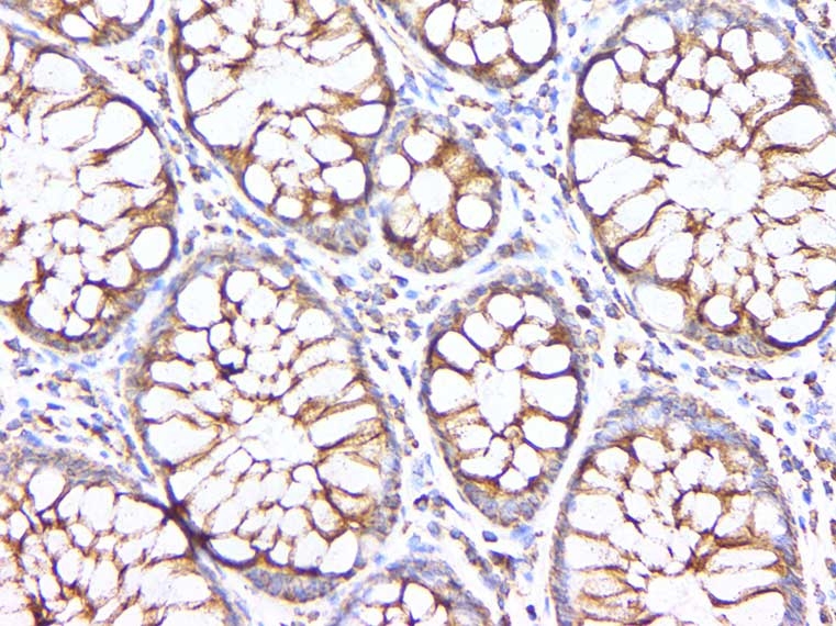 Anti-HSP60 Rabbit pAb