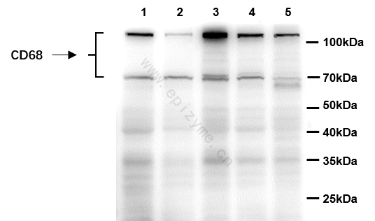 Anti-CD68 Mouse mAb [80M22L04]