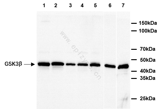 Anti-GSK3 beta Mouse mAb [53M81L36]